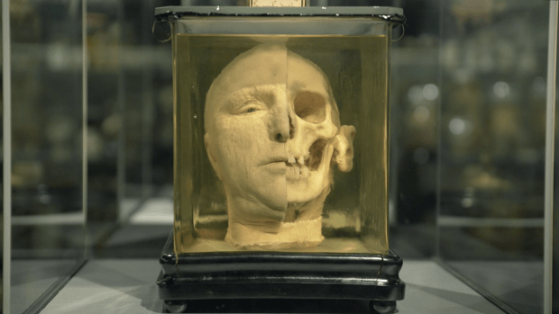 Video | &lsquo;Het is ook een verhaal van ellende, van verdriet&rsquo; in Museum Vrolik